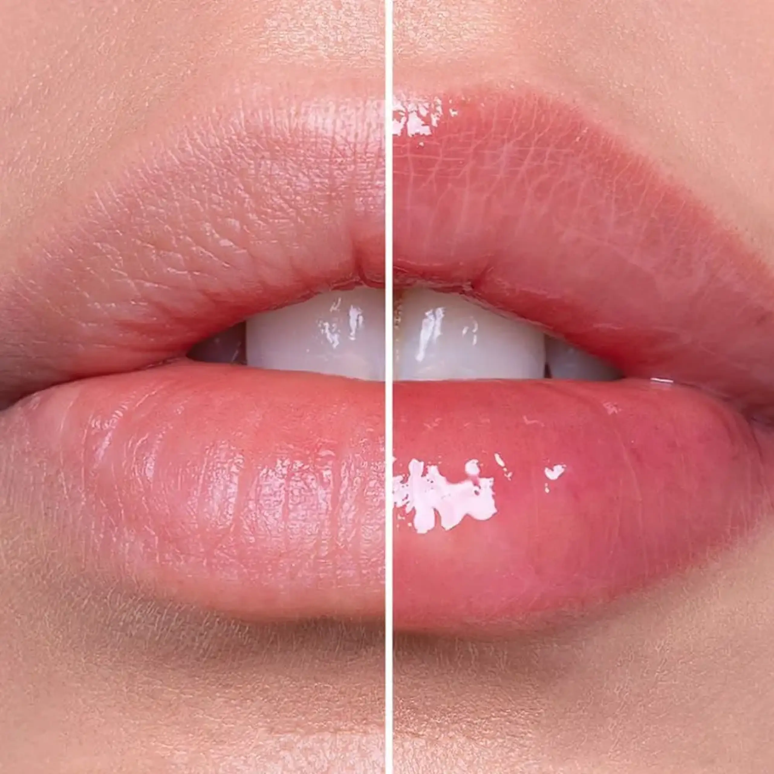 Plamper pentru buze cu spicule VT Cosmetics Reedle Shot Lip Plumper Beginner