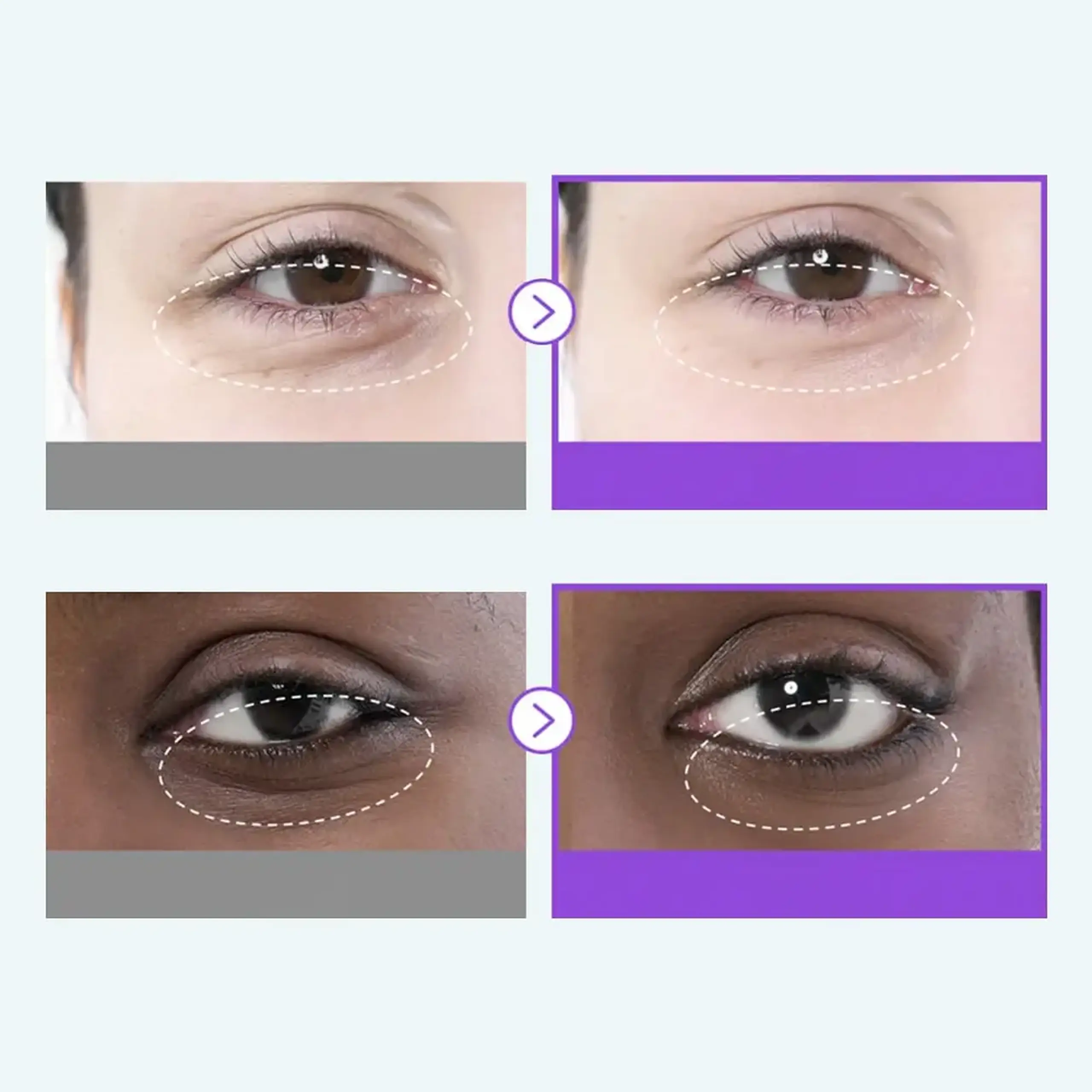 Patchuri Numbuzin No.9 NAD Collagen Under Eye Patches