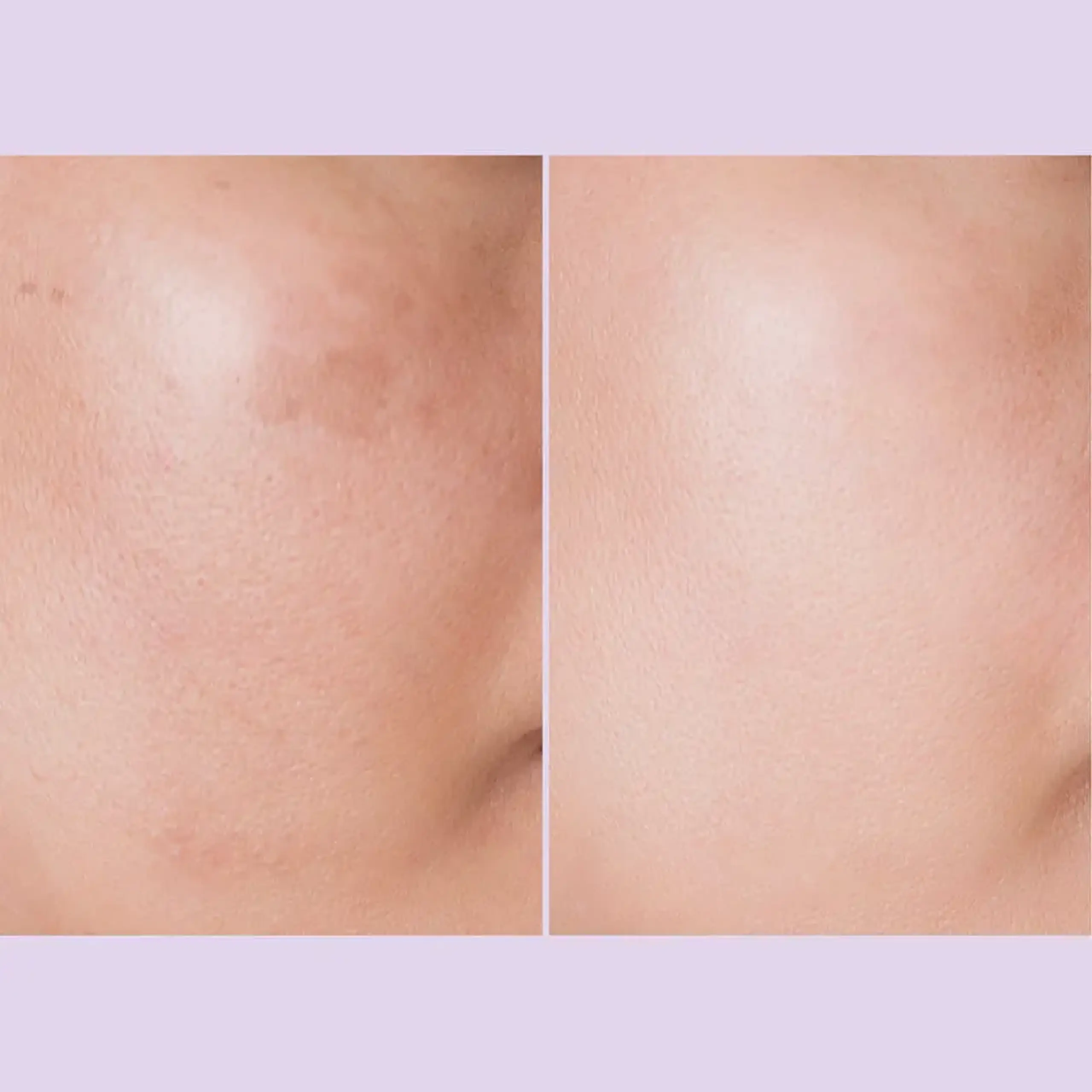 Fiolă pentru luminozitate REJURAN Triple Radiance Ampoule 30 ml