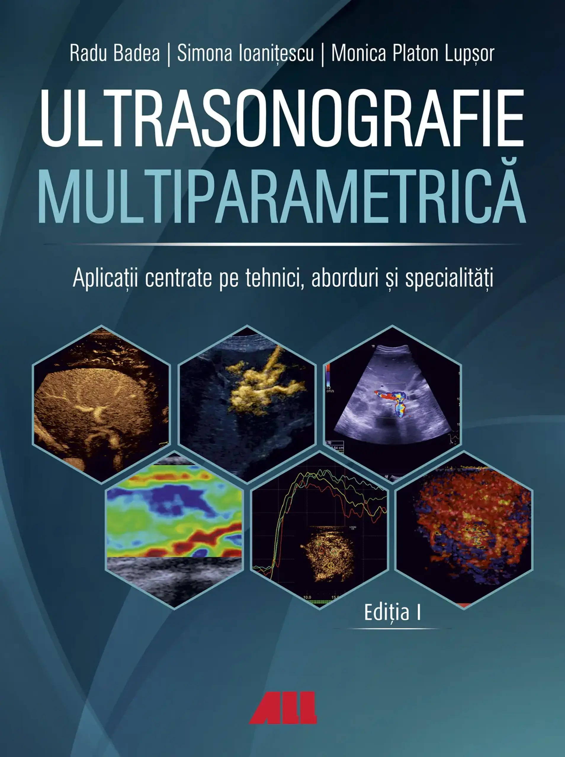 Ultrasonografie multiparametrica | Radu Badea, Simona Ioanitescu, Monica Platon Lupsor