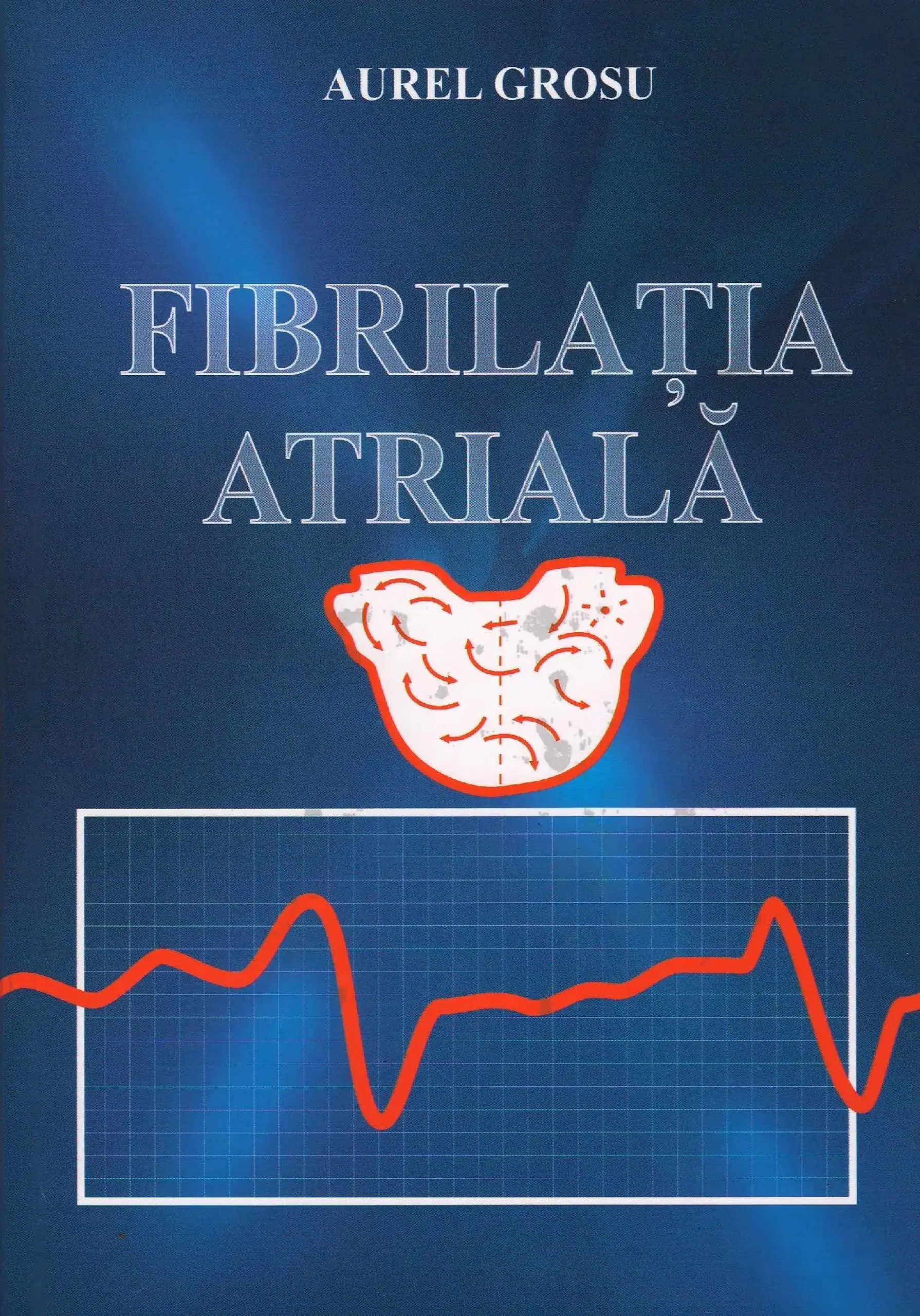 Fibrilatia artriala | Aurel Grosu